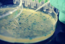 盡管越來越難以開發(fā)出新的抗生素菌株 但科學(xué)家們在神經(jīng)網(wǎng)絡(luò)的幫助下做到了這一點