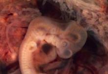 對(duì)人類大腦發(fā)育的獨(dú)特見解:早期胚胎大腦的模型