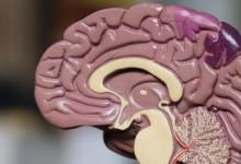 Neuralink將在下個月分享將人腦與AI連接的進(jìn)展