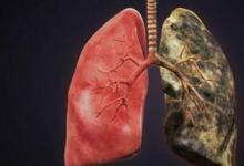 癌癥AI與多學(xué)科腫瘤委員會(huì)達(dá)成92%的最高協(xié)議