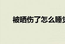 被曬傷了怎么睡覺(jué)（被曬傷了怎么辦）